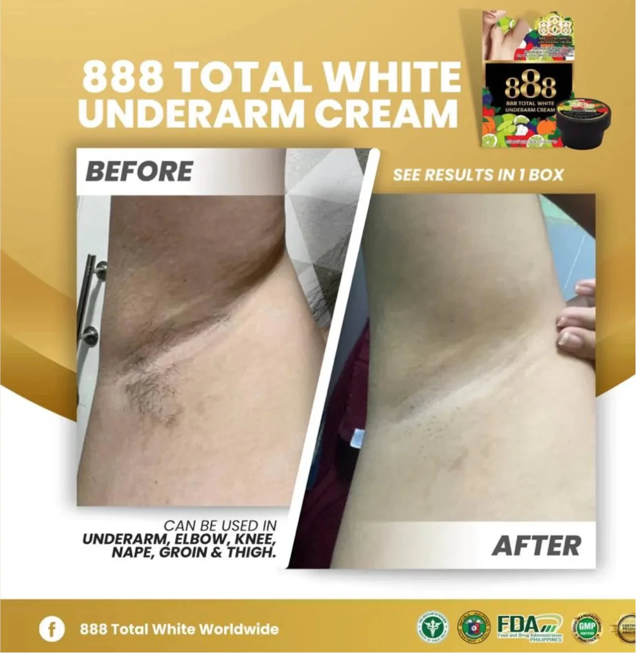 Advertisement for 888 Total White Underarm Cream showing before and after effects on skin.