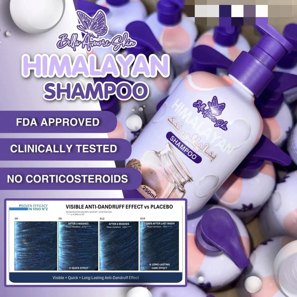 Himalayan shampoo bottles with visible anti-dandruff effect on a promotional graphic.