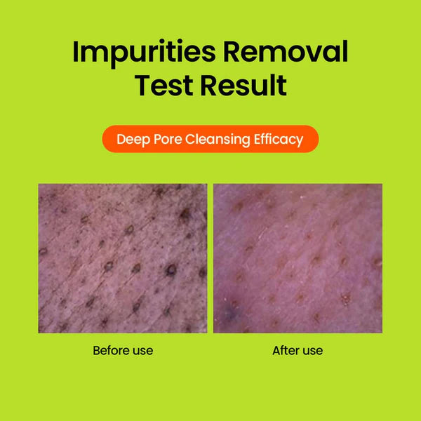 BEPLAIN Mung Bean pH-balanced Cleansing Foam