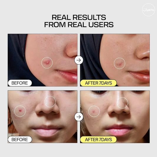 Snail Mucin 95 + Peptide Facial Essence - Jjoseon Beauty