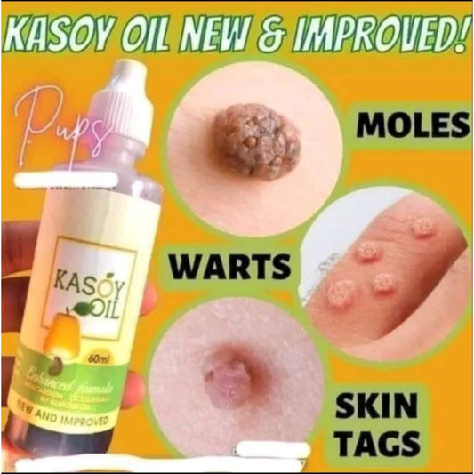 Kasoy Oil