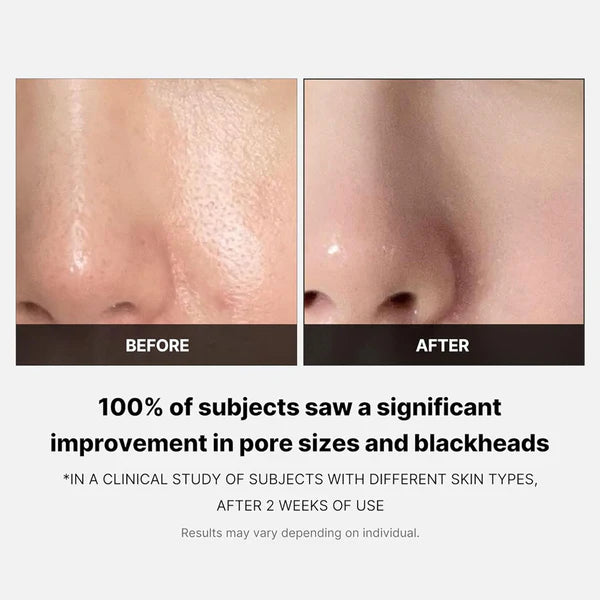 MEDICUBE Zero Pore Pads 2.0 Dewy Demure Australia before and after