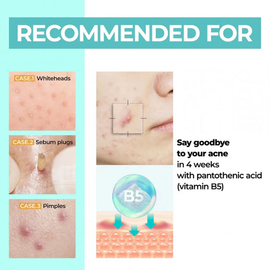 No.1 Pantothenic B5 Active Soothing Cream - Jjoseon Beauty