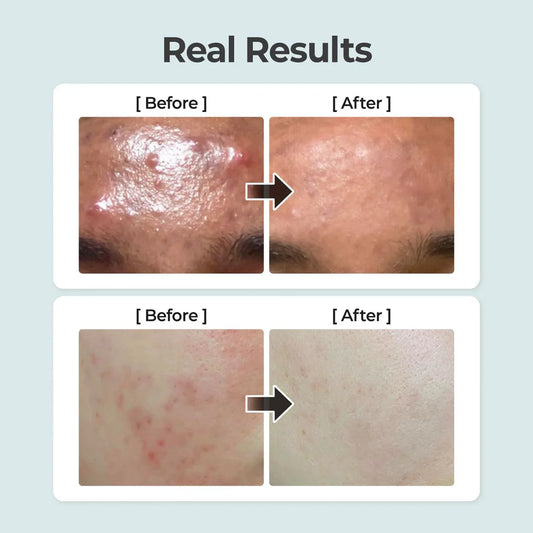 No.1 Pure-full Calming Herb Toner - Jjoseon Beauty