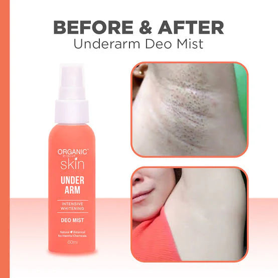 Organic Skin Underarm Intensive Lightening Deo Mist