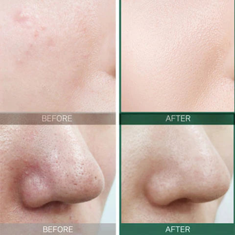 AHA-BHA-PHA 30 Days Miracle Toner - Jjoseon Beauty