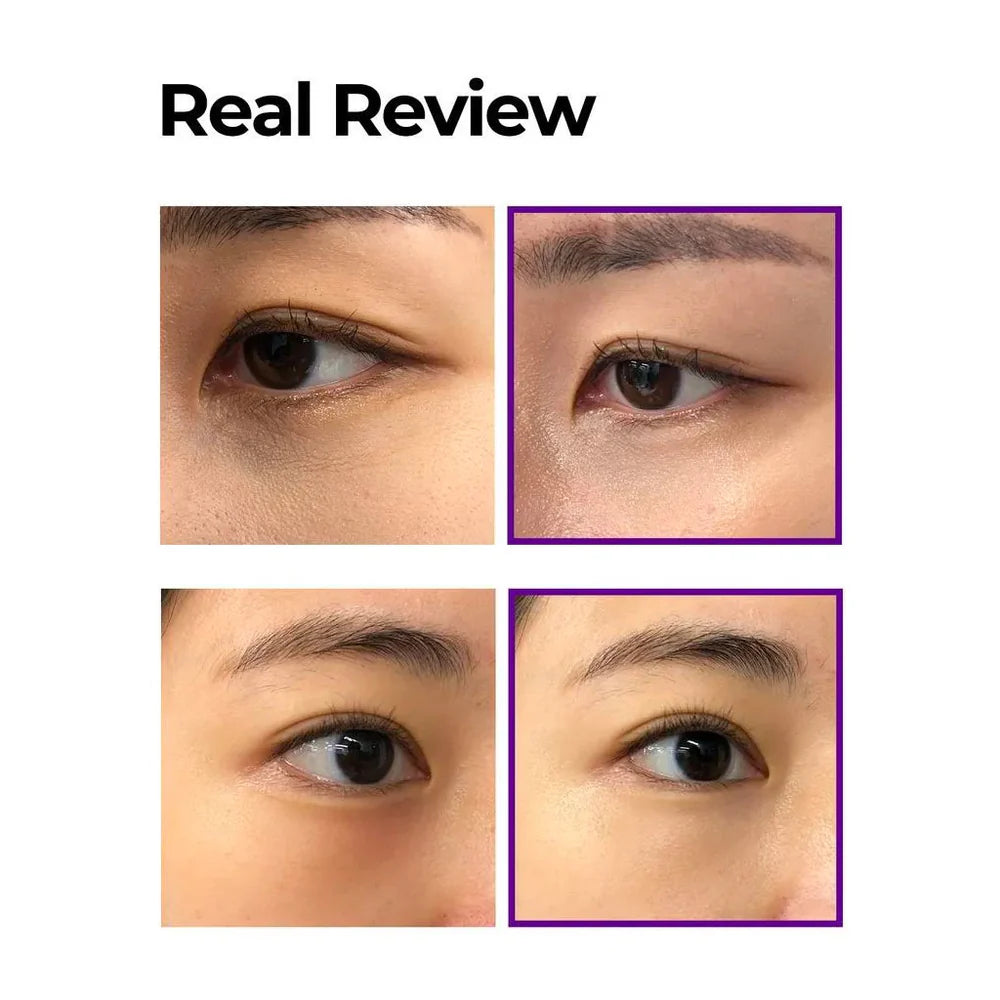 Retinol Intense Advanced Triple Action Eye Cream - Jjoseon Beauty