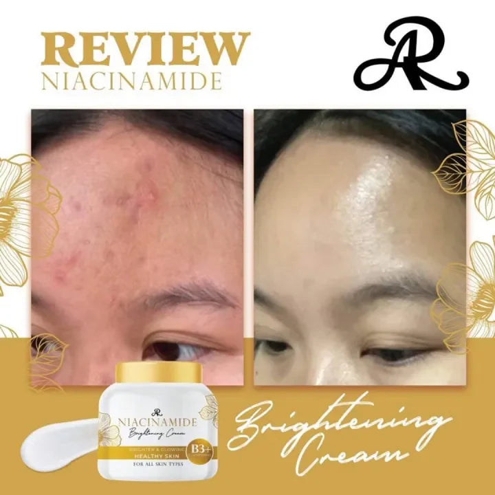 Before and after comparison of skin with niacinamide brightening cream and product packaging.