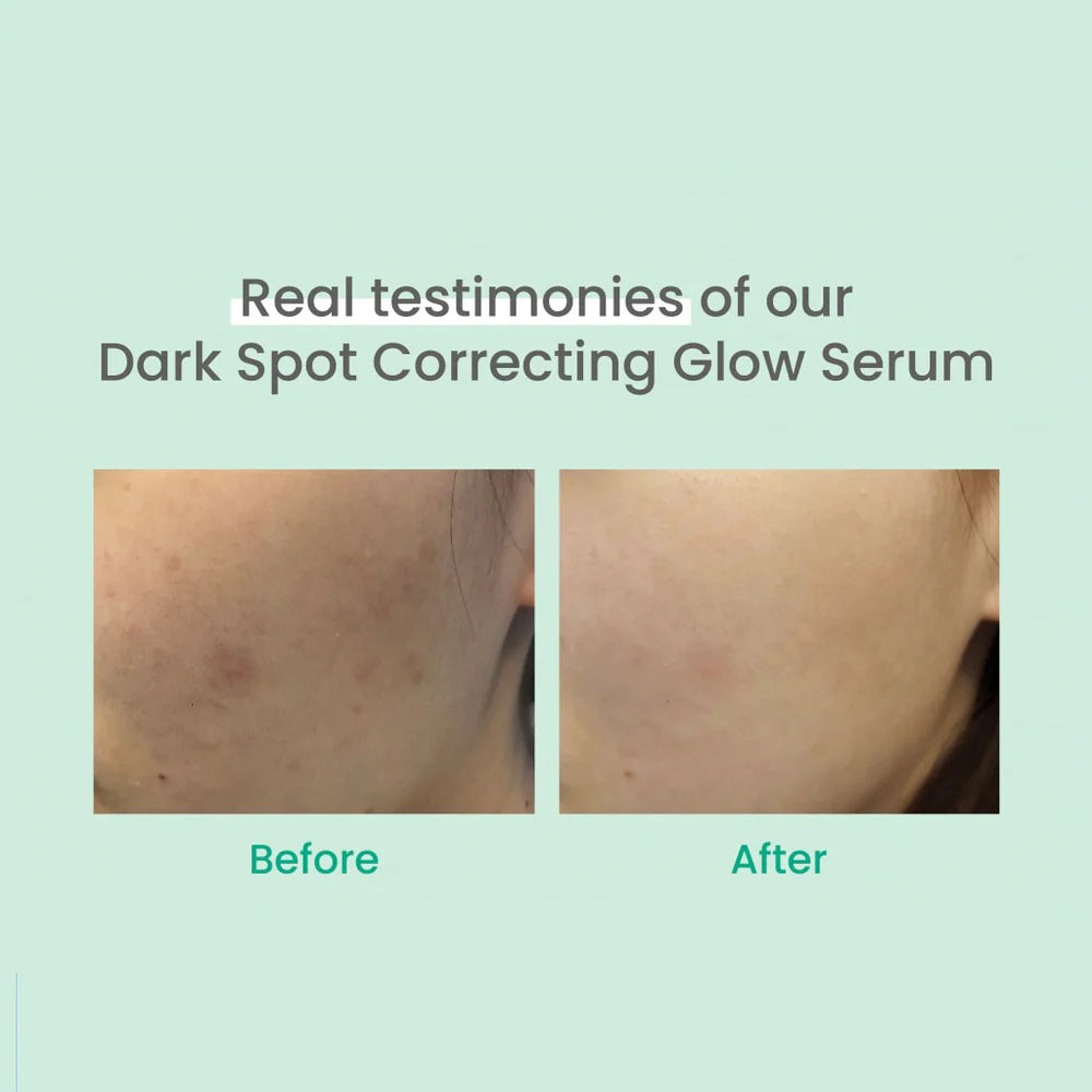 AXIS-Y Dark Spot Correcting Glow Serum Dewy Demure Australia before and after