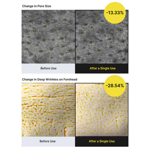 Before and after effects of a skincare product on pore size and deep wrinkles.