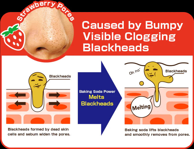 Diagram explaining blackhead removal with baking soda, showing a nose with pores and blackheads.