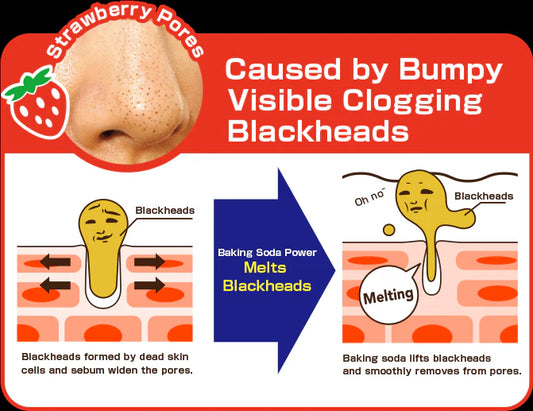 Diagram explaining blackhead removal with baking soda, showing a nose with pores and blackheads.