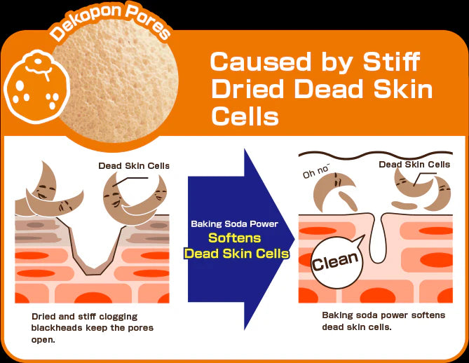 Diagram explaining the cause of clogged pores due to stiff dried dead skin cells and the effect of baking soda on softening them.