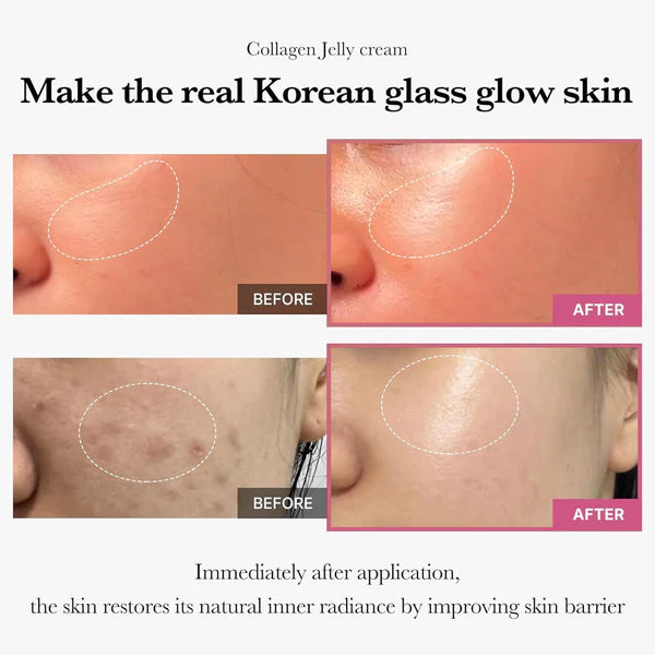 MEDICUBE Collagen Jelly Cream Dewy Demure Australia before and after
