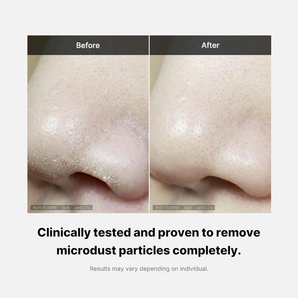 Before and after comparison of a nose with text indicating microdust particle removal.