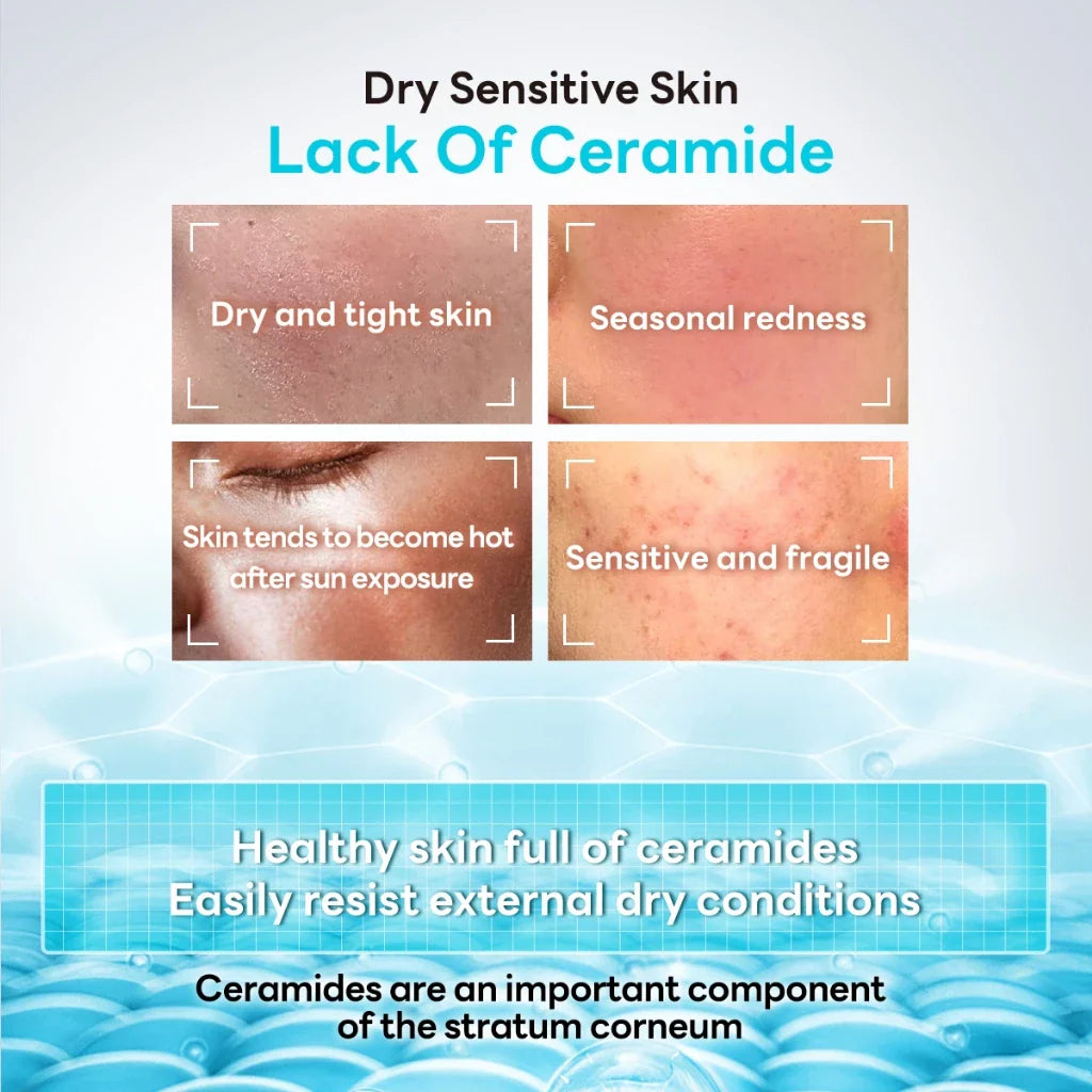 Diagram of dry sensitive skin with lack of ceramides and healthy skin full of ceramides.