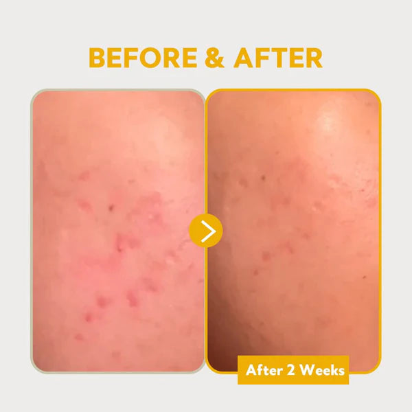 Pure Vitamin C24 Serum